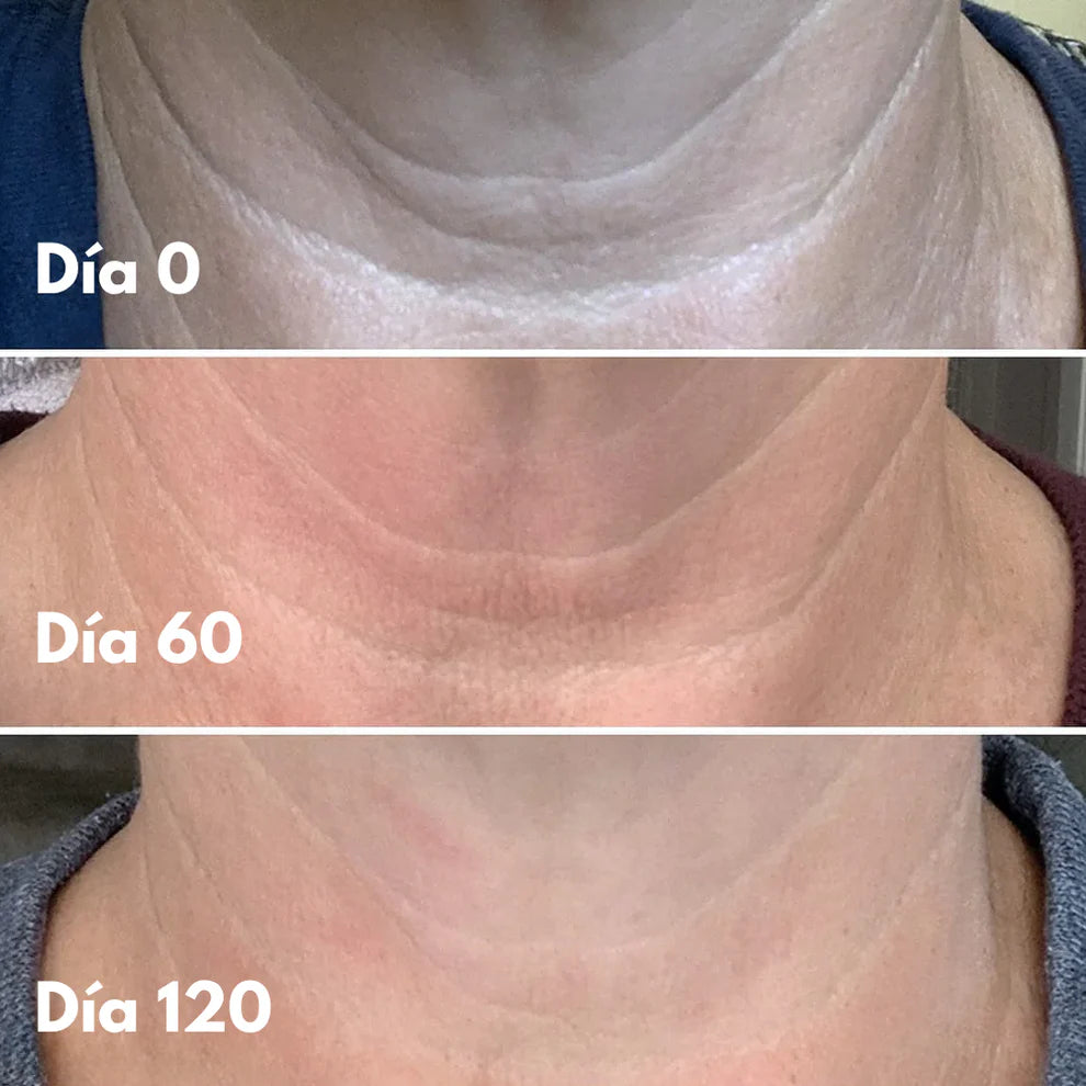 Crema reafirmante - Cuello y papada